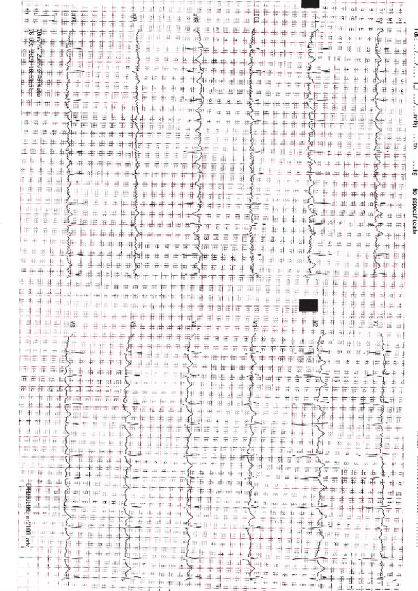 Miniatura del documento EJEMPLO-PRACTICA-ELECTROCARDIOGRAMA.pdf