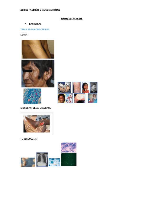 Miniatura del documento FOTOS SOLO 2º PARCIAL-ali y sara.pdf