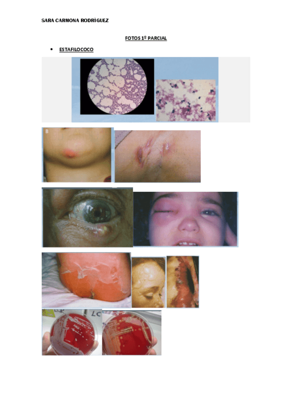 Miniatura del documento FOTOS-1o-PARCIAL-MICRO-SARA-CARMONA.pdf