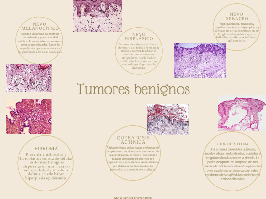 Miniatura del documento Neoplasias-en-Dermatologia.pdf