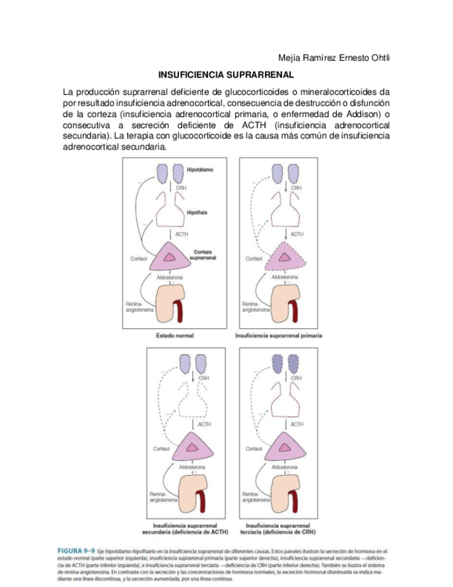 Miniatura del documento Insuficiencia-Suprarrenal.pdf