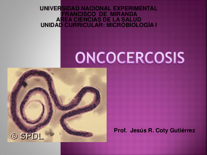 Miniatura del documento ONCOCERCOSIS.pdf