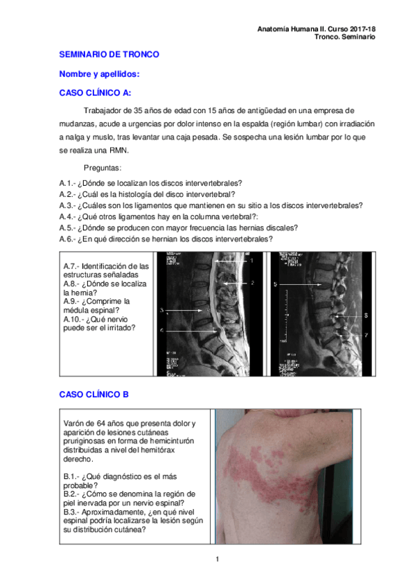 Miniatura del documento Tronco.-Seminario.pdf