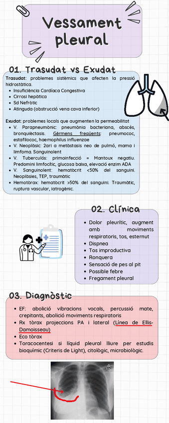 Miniatura del documento Vessament-pleural.pdf