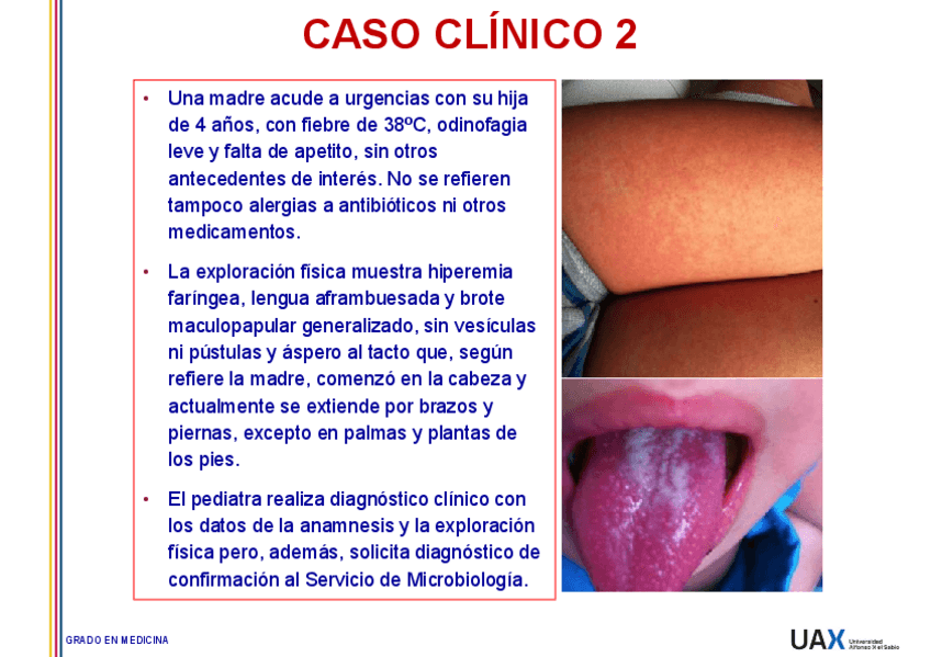 Miniatura del documento Caso-2-Escarlatina-resuelto.pdf