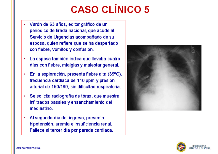 Miniatura del documento Caso-5-Bacillus-antracis-pulmonar.pdf