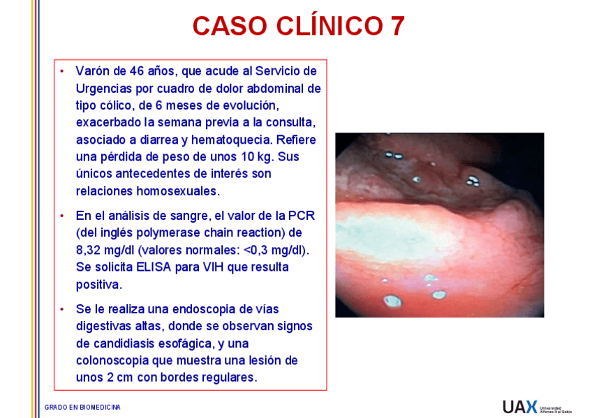 Miniatura del documento Caso-7-Tuberculosis-intestinal.pdf
