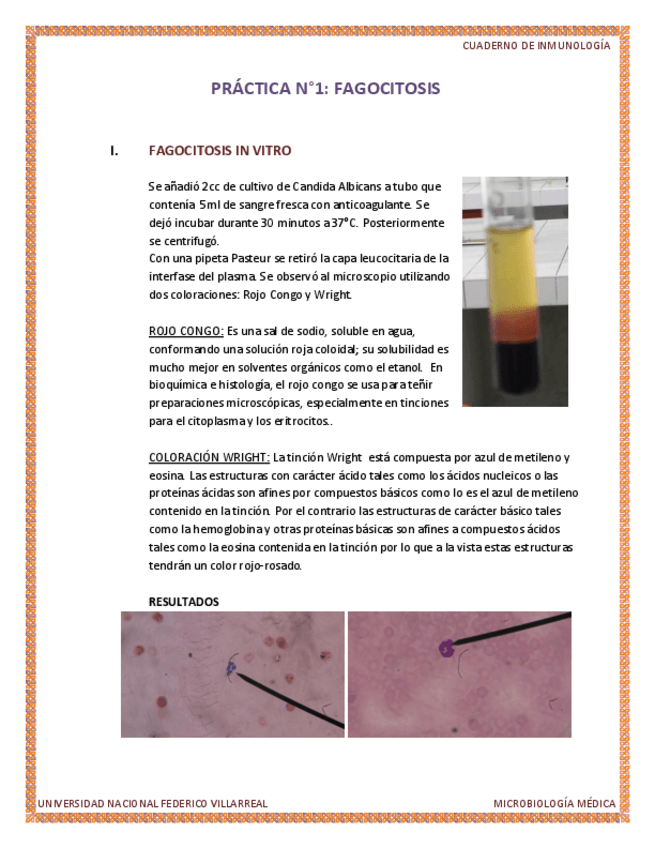 Miniatura del documento INFORME-CUADERNO-DE-INMONOLOGIA-FAGOCITOSIS-JFE.pdf