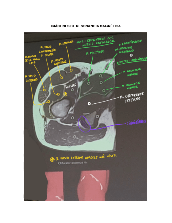 Miniatura del documento RADIOLOGIA-IMAGENES-DE-APOYO.pdf