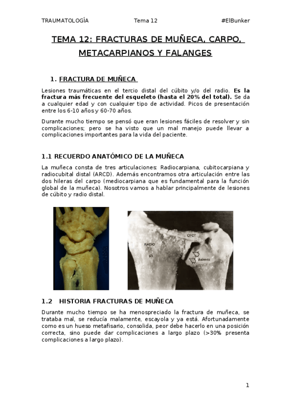 Miniatura del documento TEMA-12-Fracturas-de-muneca-carpo-y-mano.docx
