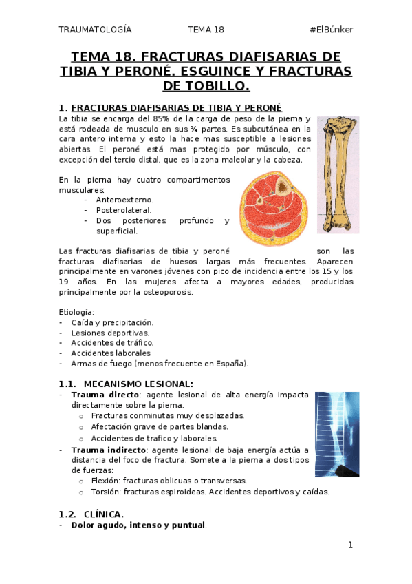 Miniatura del documento TEMA-18.-FRACTURAS-DIAFISARIAS-DE-TIBIA-Y-PERONE.-ESGUINCE-Y-FRACTURA-DE-TOBILLO.docx