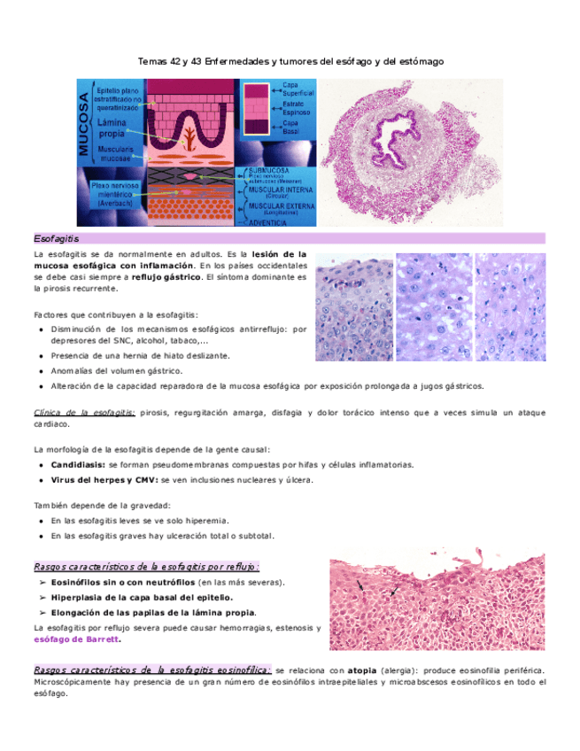 Miniatura del documento Tema-42-y-43-Enfermedades-del-esofago-y-del-estomago.pdf