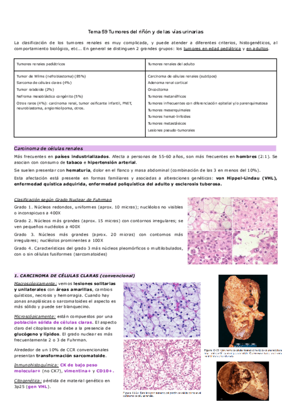 Miniatura del documento Tema-59-Tumores-del-rinon-y-de-las-vias-urinarias.pdf