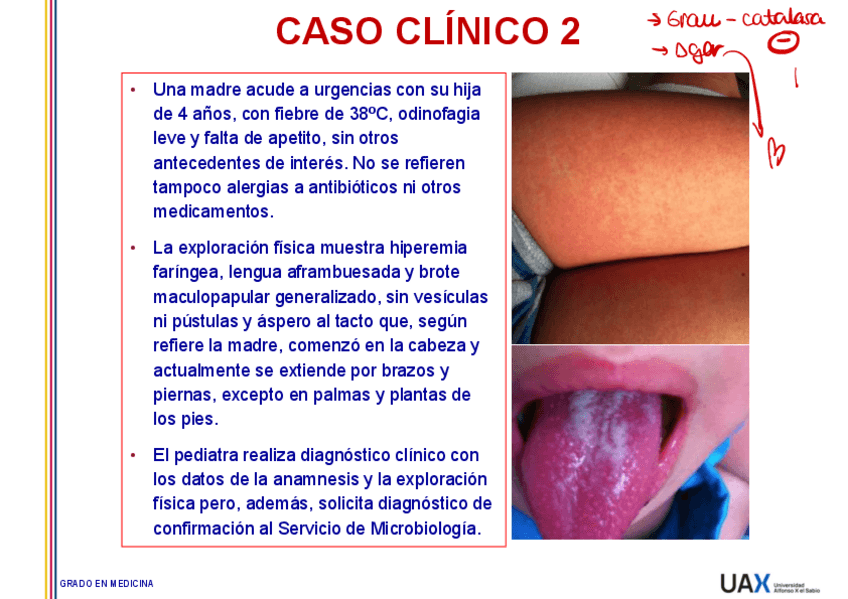 Miniatura del documento Caso-2-Escarlatina-resuelto.pdf