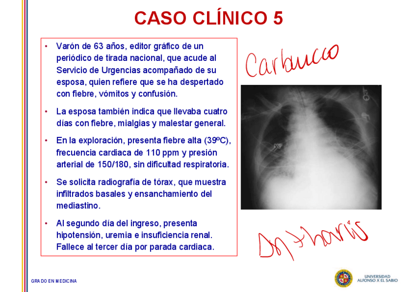 Miniatura del documento Caso-5-Bacillus-antracis-pulmonar.pdf