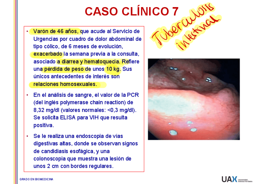 Miniatura del documento Caso-7-Tuberculosis-intestinal.pdf