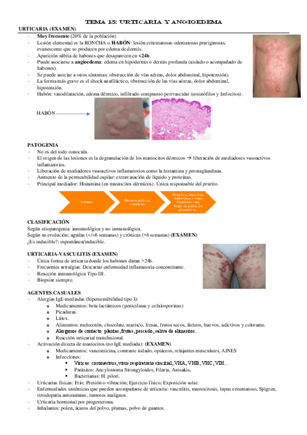 Miniatura del documento TEMA-13-Urticaria.pdf