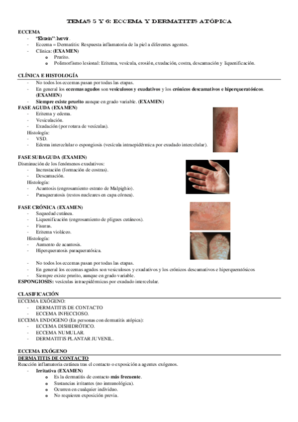 Miniatura del documento TEMAS-5-y-6-Eccema-y-dermatitis-atopica.pdf
