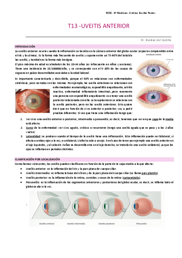 Miniatura del documento uveitis-anterior.pdf