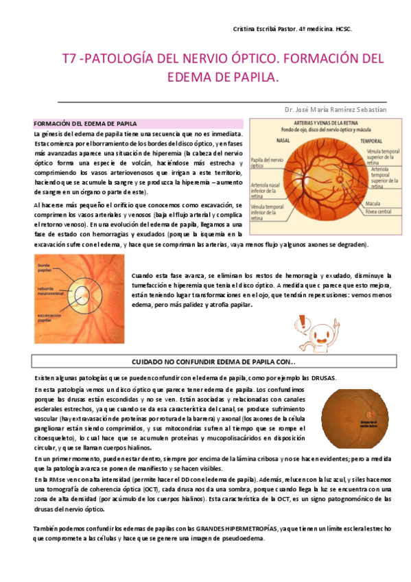 Miniatura del documento Patologia-del-nervio-optico.pdf