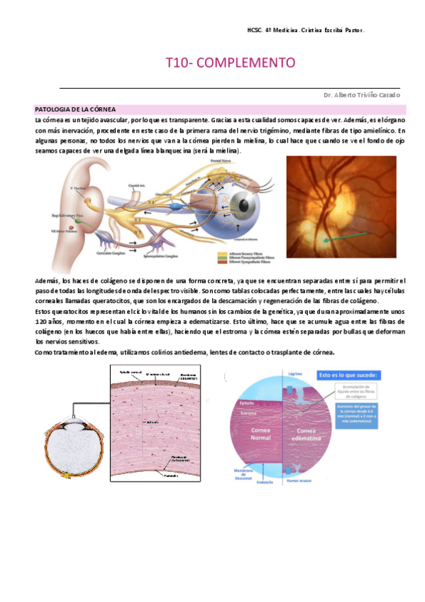 Miniatura del documento PATOLOGIA-DE-LA-CORNEA.pdf