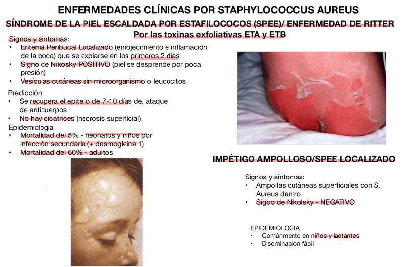 Miniatura del documento ENFERMEDADES-POR-S-AUREUS.pdf