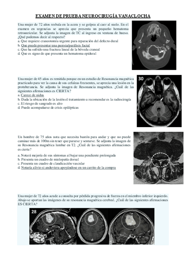 Miniatura del documento EXAMEN-DE-PRUEBA-NEUROCIRUGIA-VANACLOCHA.pdf
