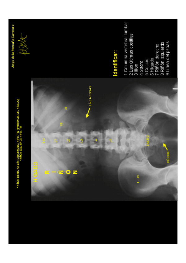 Miniatura del documento ANATOMÍA RADIOLÓGICA.pdf