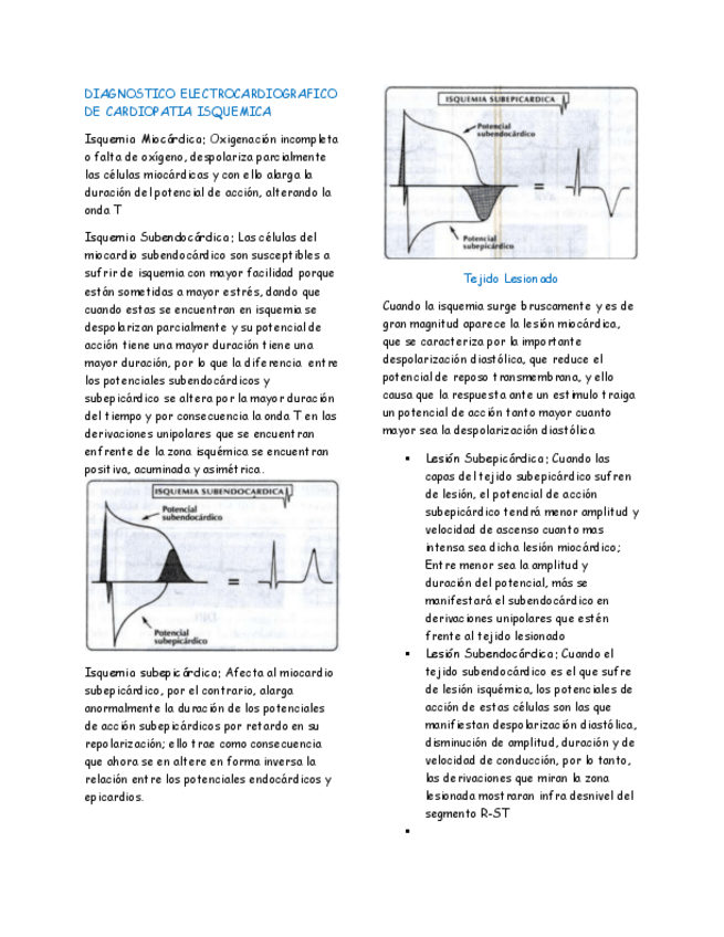 Miniatura del documento Electrocardiografia-PT-4.-Emiliano-Vega-Ornelas.pdf