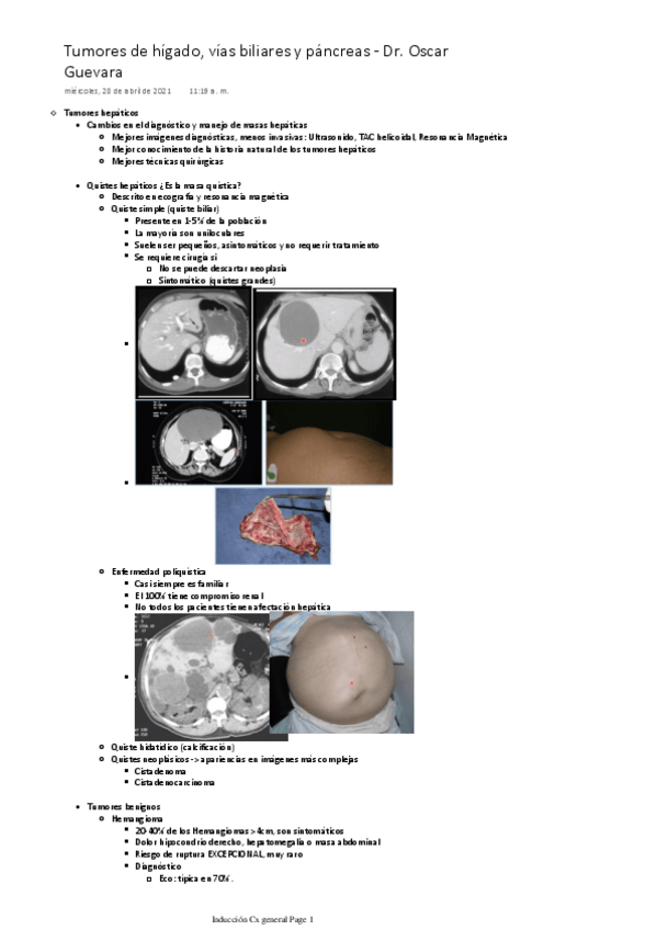 Miniatura del documento Tumores-de-higado-vias-biliares-y-pancreas.pdf