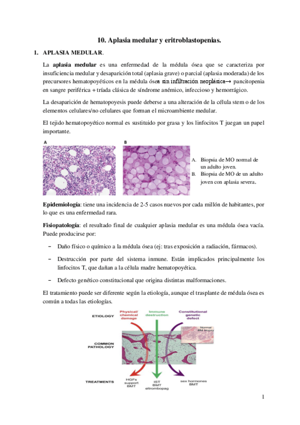 Miniatura del documento 10.-Aplasia-medular.pdf