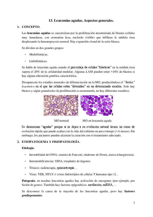 Miniatura del documento 13.-Leucemias-agudas.-Aspectos-generales.pdf
