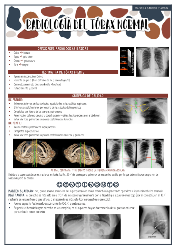 Miniatura del documento RADIOLOGIA-DE-TORAX-NORMAL.pdf