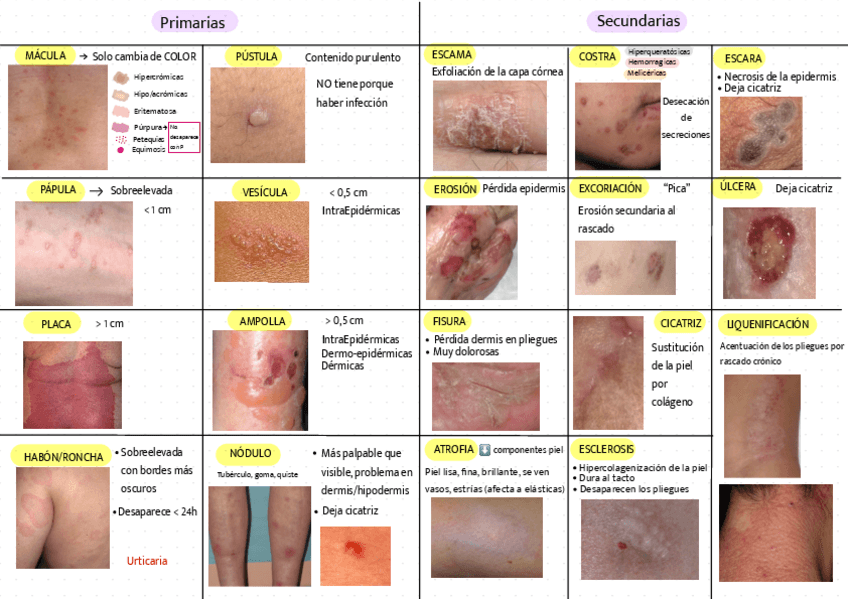 Miniatura del documento Lesiones-elementales.pdf