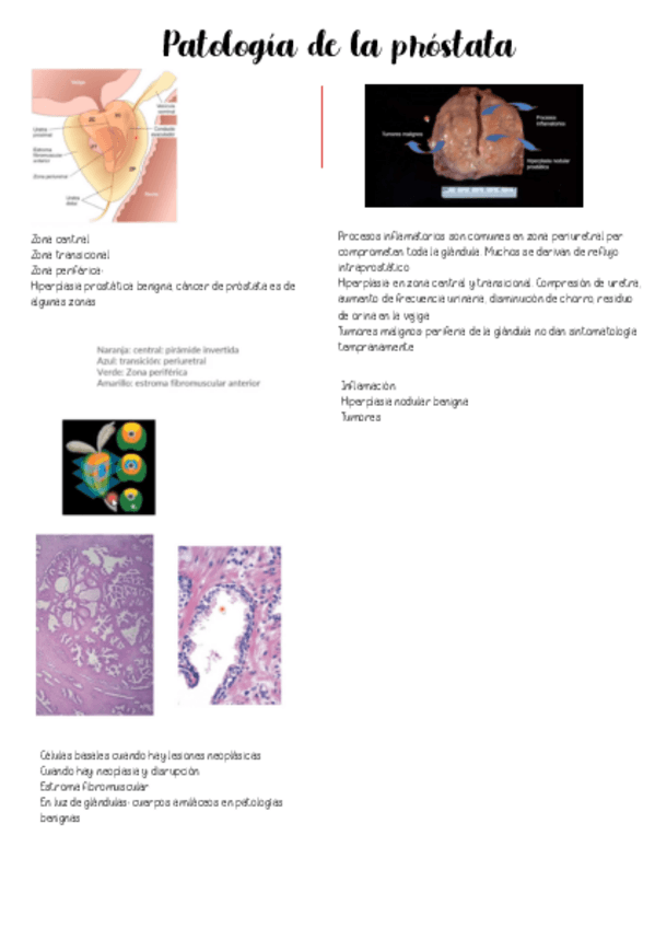 Miniatura del documento Patologia-Prostata.pdf