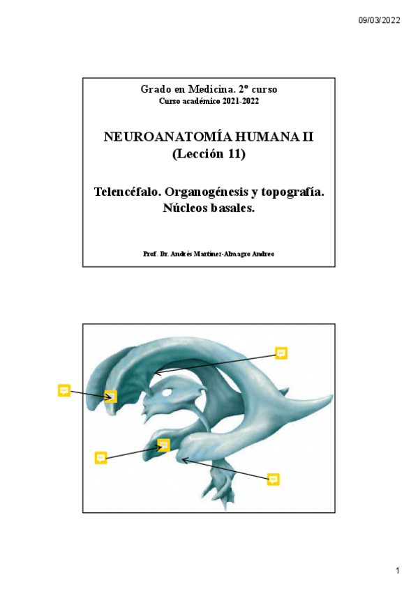 Miniatura del documento Leccion-11.-Nucleos-basalesunlocked.pdf