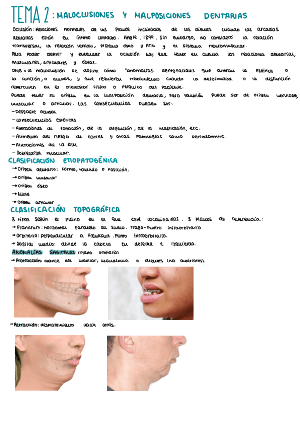 Miniatura del documento Tema-2-maloclusiones.pdf