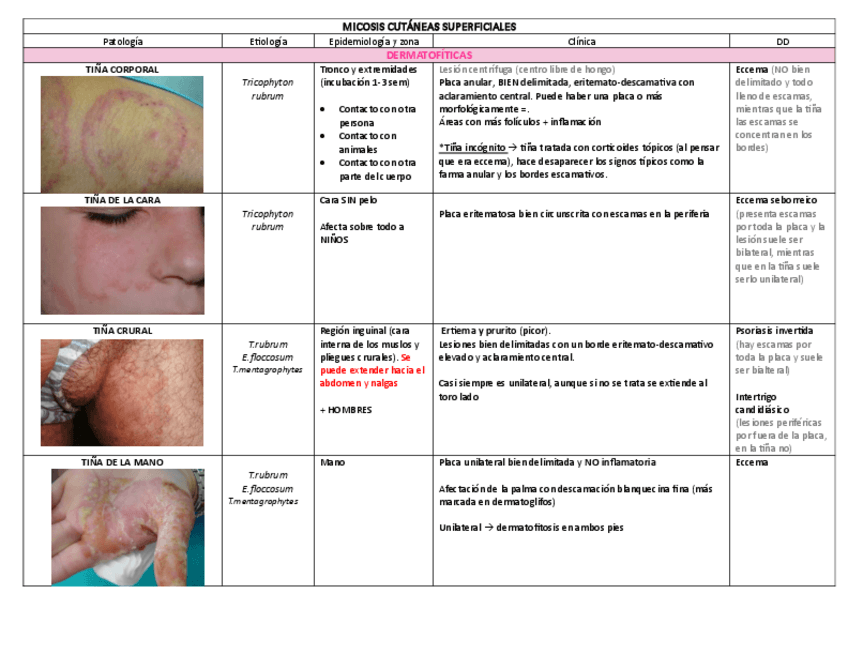Miniatura del documento MICOSIS-CUTANEAS-SUPERFICIALES.pdf