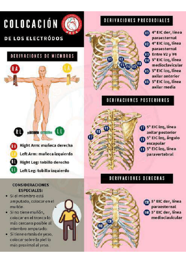 Miniatura del documento COLOCACION-ELECTRODOS.pdf