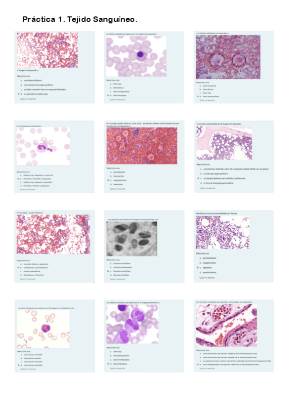 Miniatura del documento Práctica 1. Cuestionario Tejido Sanguíneo.pdf