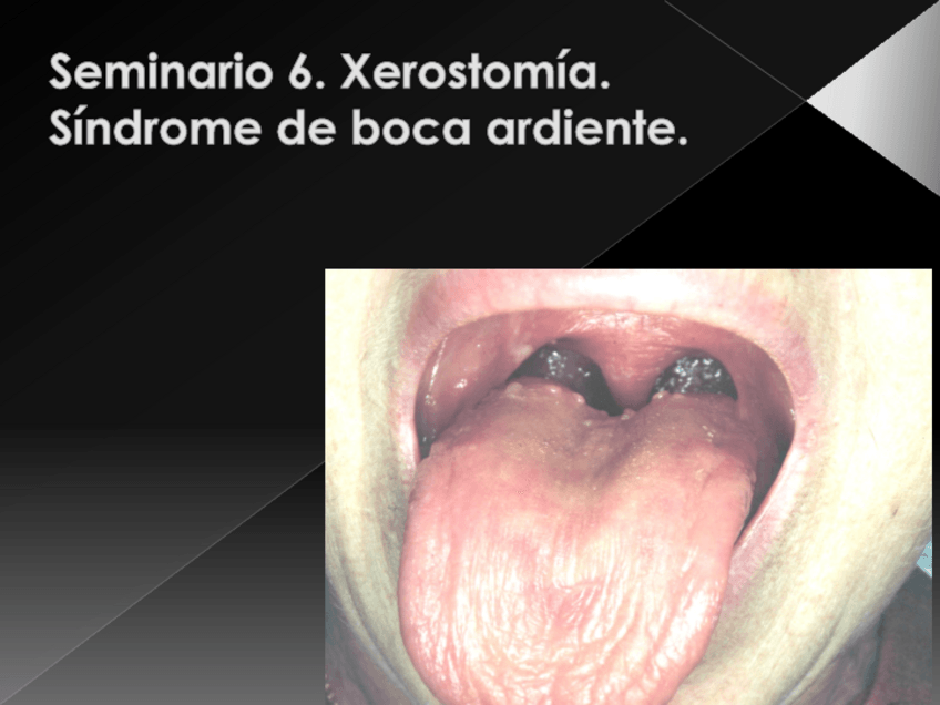 Miniatura del documento Xerostomia-23.pdf