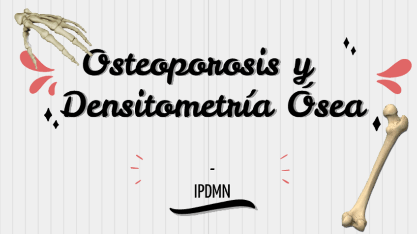 Miniatura del documento powerpoint-osteoporosis.pdf