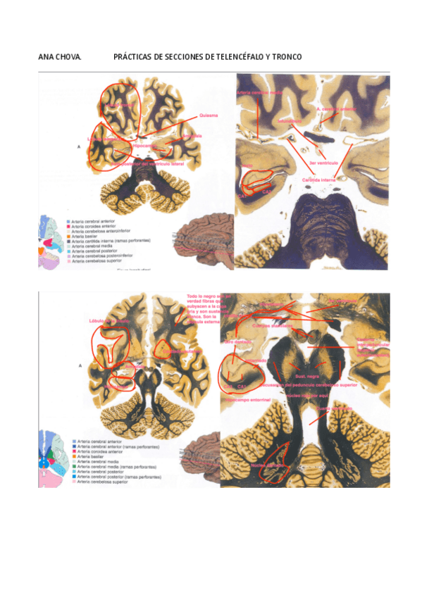 Miniatura del documento Practica-de-cortes-de-encefalo-y-telencefalo.pdf