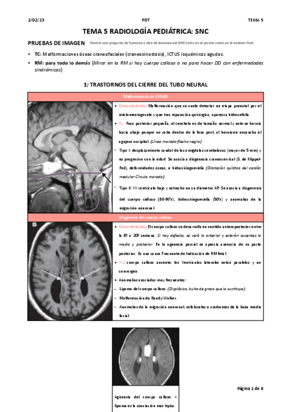 Miniatura del documento Tema-5-Rx-pediatrica-SNC.pdf