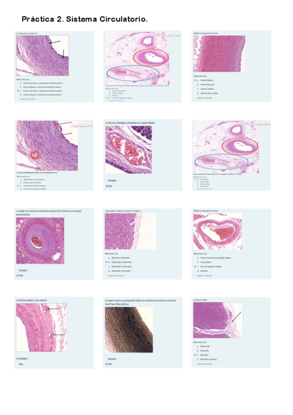 Miniatura del documento Práctica 2. Cuestionario Aparato Circulatorio.pdf