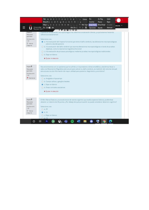 Miniatura del documento Evaluacion-Neuropsicologica-T-1-4.pdf