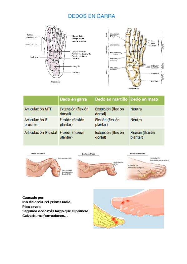 Miniatura del documento DEDOS-GARRA.pdf