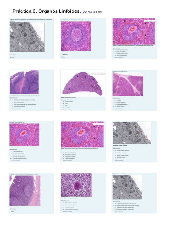 Miniatura del documento Práctica 3. Cuestionario Órganos Linfoides.pdf
