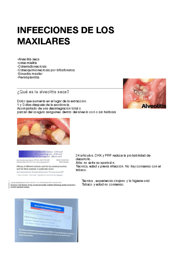 Miniatura del documento Tema-20.-Infecciones-maxilares.pdf