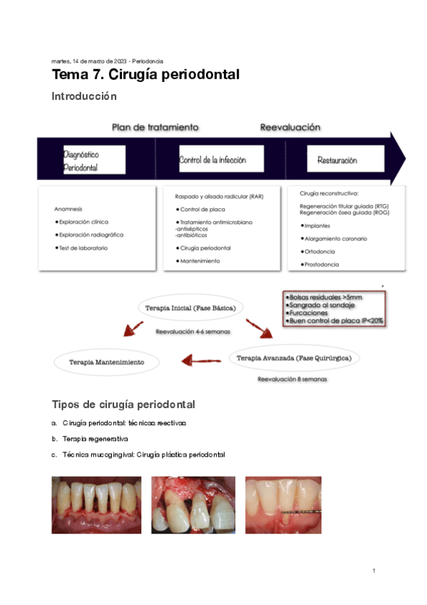 Miniatura del documento Tema-7.-Cirugia-periodontal.pdf